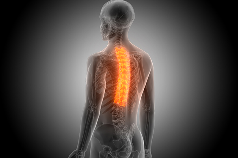 Tampa Spinal Cord Injury Attorney
