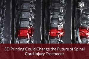 3D Printing Could Change the Future of Spinal Cord Injury Treatment