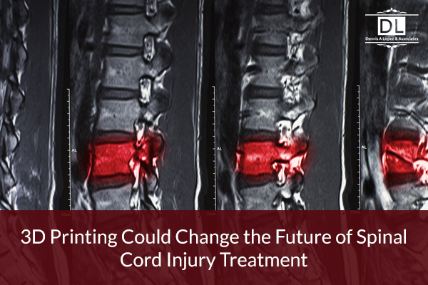 3D Printing Could Change the Future of Spinal Cord Injury Treatment